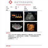 超声科胶片 干式热敏胶片 喷墨胶片 菲力姆供